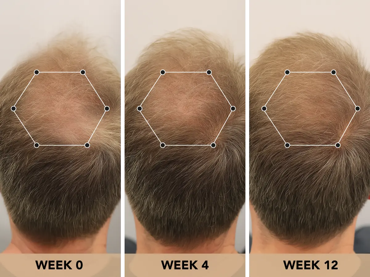 Root Activator Shampoo™
