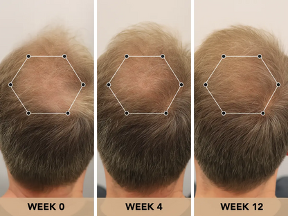 Root Activator Shampoo™