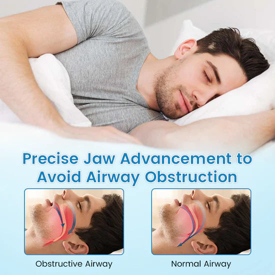 Anti-Snoring & Anti-Grinding Mouthpiece
