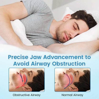 Anti-Snoring & Anti-Grinding Mouthpiece